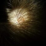8 Simple steps will help you remove dandruff permanently