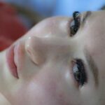 10 Easy Home Remedies for Effective Blackheads Removal