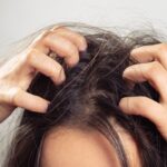 Itchy scalp treatment with basic home remedies
