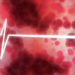 Understanding High Blood Pressure - Causes, Symptoms, and Lifestyle Tips for Control