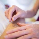 What is Acupuncture - A Beginner’s Guide to Traditional Chinese Medicine