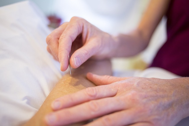 What is Acupuncture - A Beginner’s Guide to Traditional Chinese Medicine